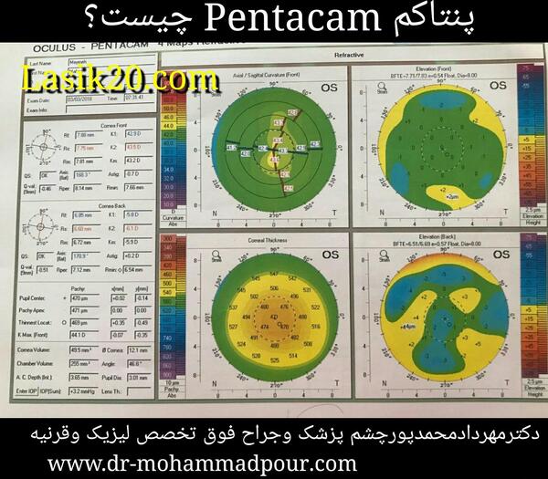 عکس رنگی چشم چیست