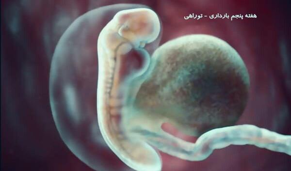 عکس بچه سقط شده هفت هفته