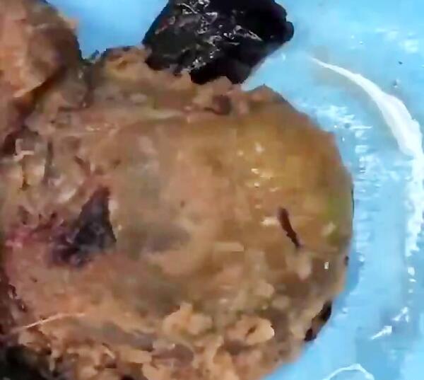 عکس بچه سقط شده هفت هفته