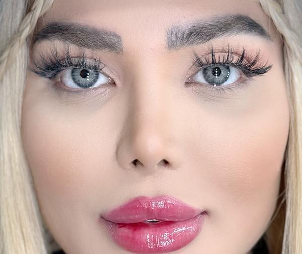 عکس لنز چشم یخی