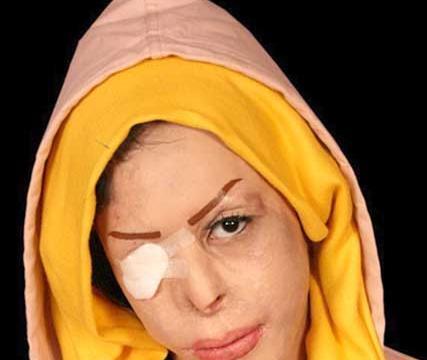 عکس چشم شیرین