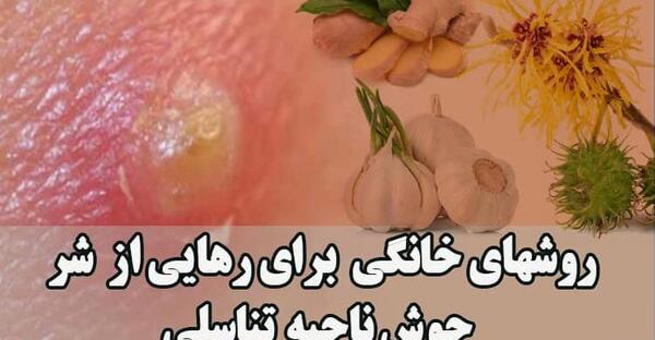 عکس جوش ناحیه تناسلی زن