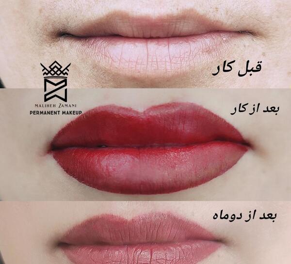 عکس تاتو لب قبل و بعد