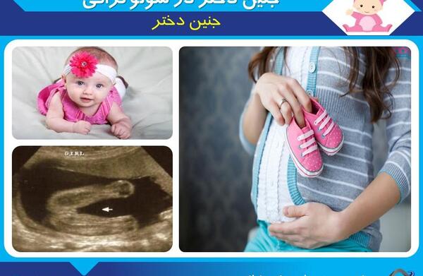 عکس جنین دختر در سونوگرافی آنومالی