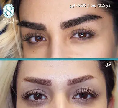 عکس از چشم و ابروی زیبا