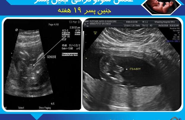 عکس جنین 14 هفته پسر