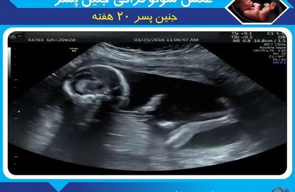عکس جنین 14 هفته پسر