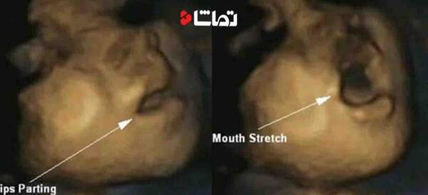 عکس جنین 14 هفته پسر