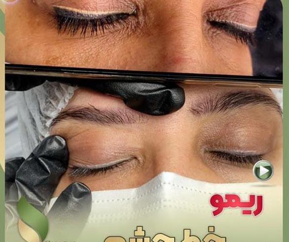 عکس عفونت تاتو خط چشم