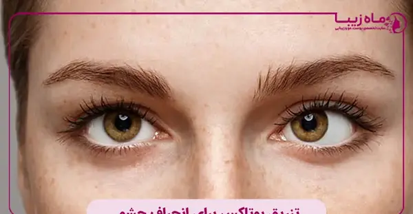 عکس از چشم لوچ