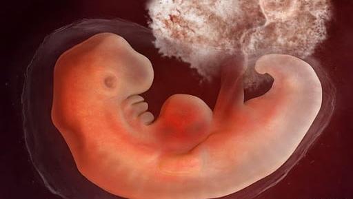 عکس جنین سقط شده ی شش هفته ای