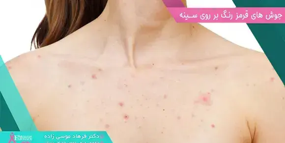 عکس جوش خوشه ای