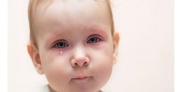 عکس بچه چشم ریز