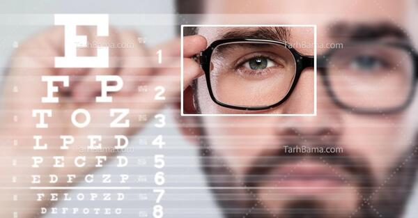 عکس چشم پزشکی معاینه