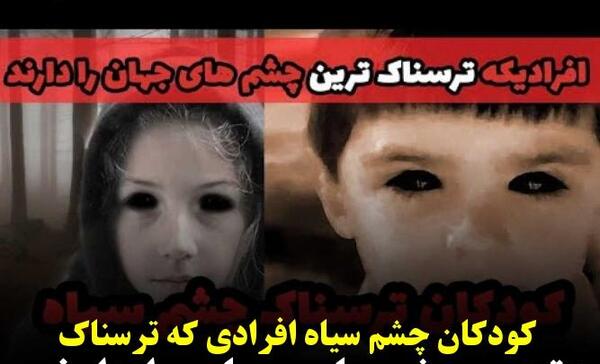عکس ترسناک ترین بچه جهان