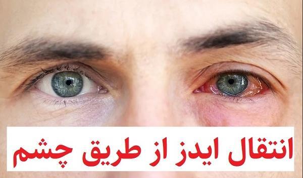 عکس چشم خونی فیک