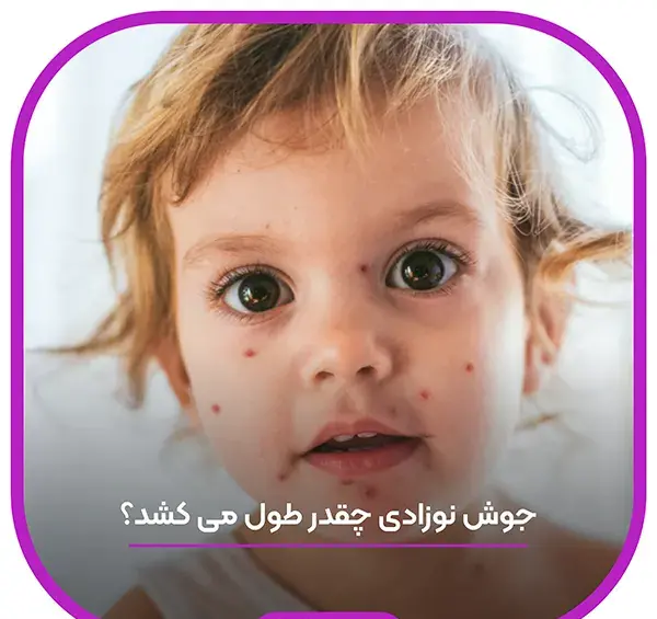 عکس انواع جوش در کودکان