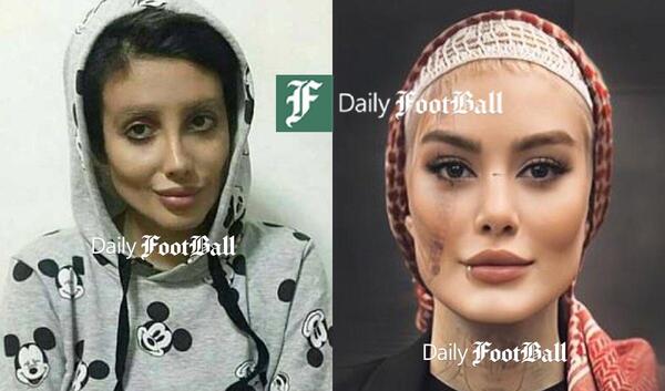 عکس های زشت تتلو و سحر قریشی