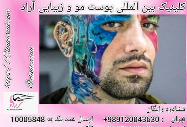 عکس تاتو روی شکم امیر تتلو