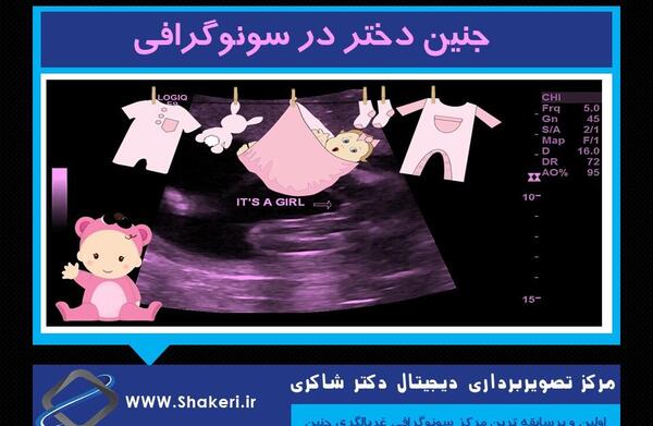 عکس جنین دوازده هفته پسر سقط شده