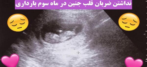 عکس جنین دوازده هفته پسر سقط شده