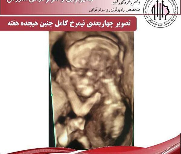 عکس سونوگرافی چهره جنین