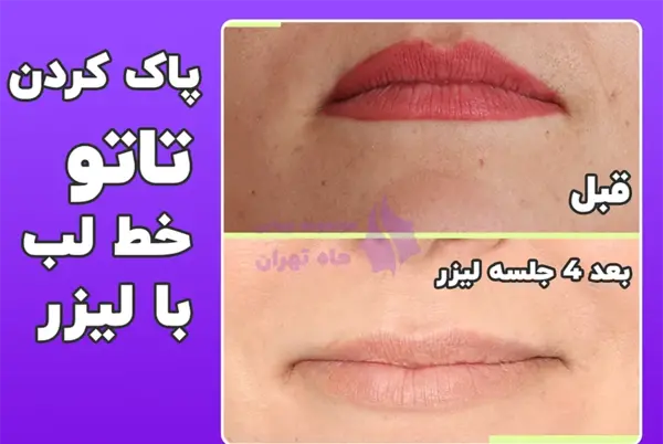 عکس تاتو خط لب و رژلب