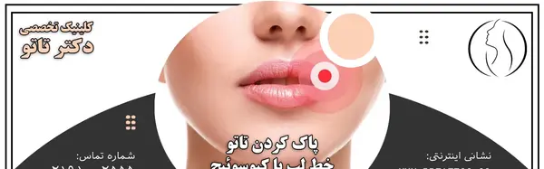 عکس تاتو خط لب قهوه ای