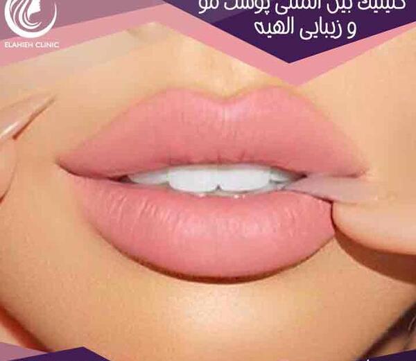 عکس تاتو خط لب قهوه ای
