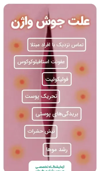 عکس انواع جوش ناحیه تناسلی زنان