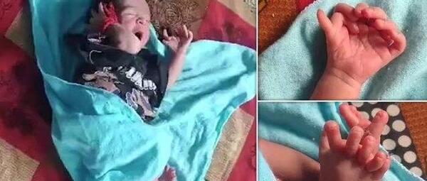 عکس تولد نوزاد وحشتناک در شیراز