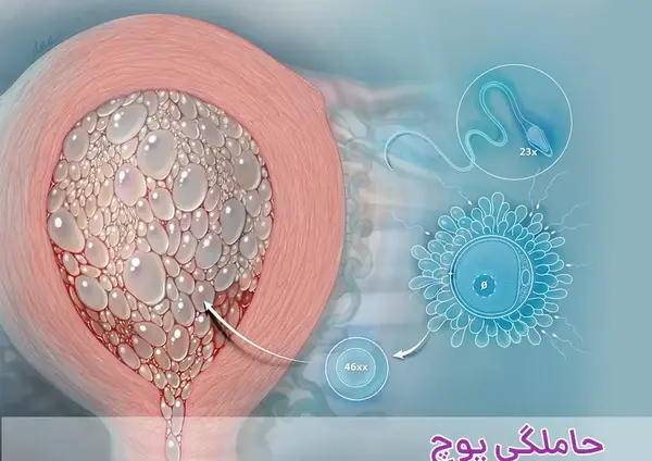 زایمان عکس بچه خوره در رحم