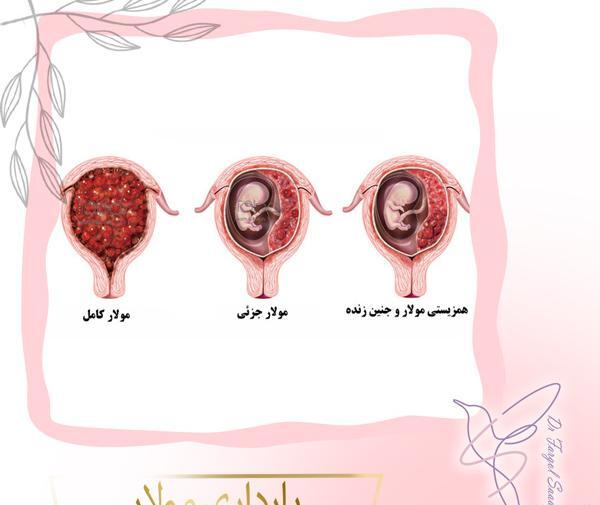 زایمان عکس بچه خوره در رحم