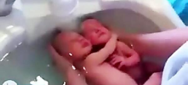 عکس بچه کوچولو که تازه به دنیا اومده