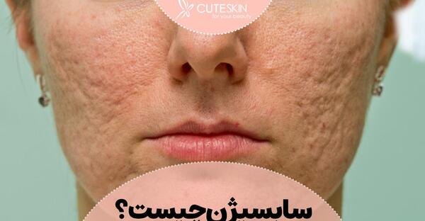 عکس صورت بعد از سابسیژن