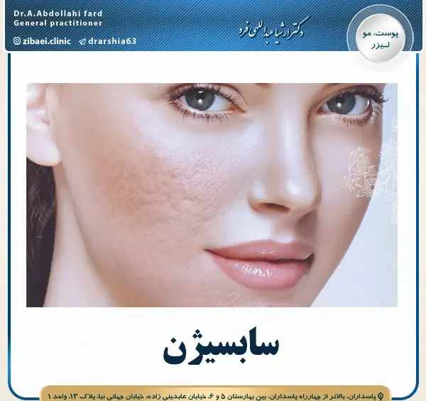 عکس صورت بعد از سابسیژن