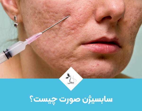 عکس صورت بعد از سابسیژن