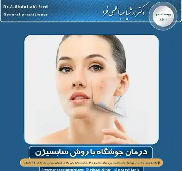 عکس صورت بعد از سابسیژن