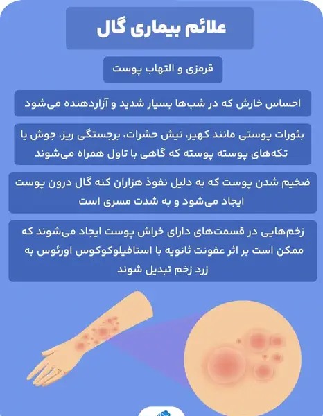 عکس بیماری گال در ناحیه تناسلی