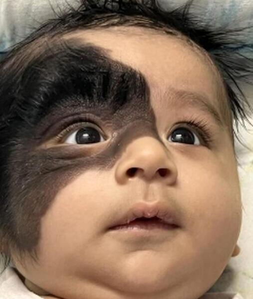 عکس بچه نوزاد زشت