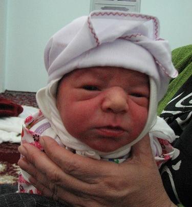 عکس بچه نوزاد زشت