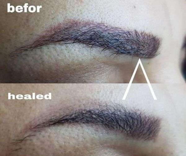 عکس تاتو ابرو پاک شده