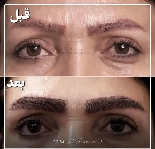 عکس تاتو ابرو پاک شده