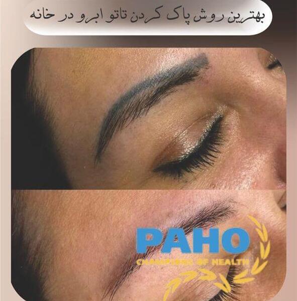 عکس تاتو ابرو پاک شده