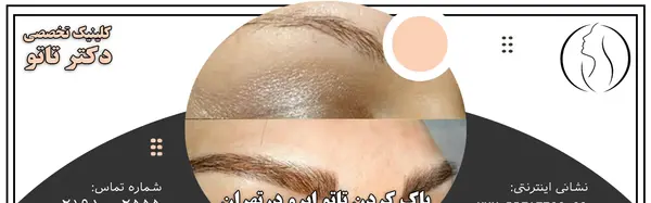 عکس تاتو ابرو پاک شده