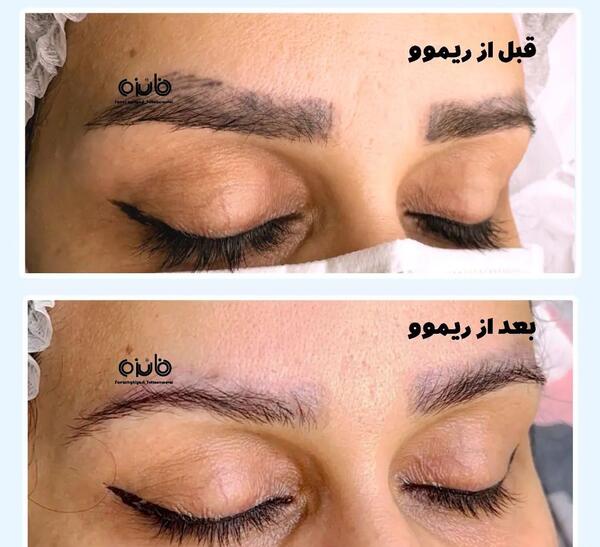عکس تاتو ابرو پاک شده