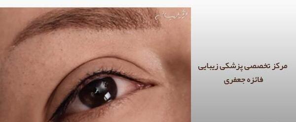 عکس از تاتو بن مژه