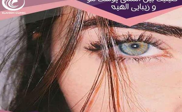عکس پروفایل تاتو صورت