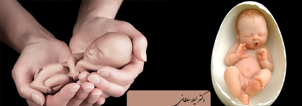 عکس بچه سقط شده دو ماه