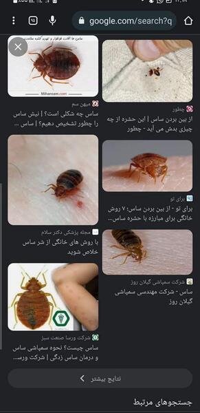 عکس عكس بچه ساس